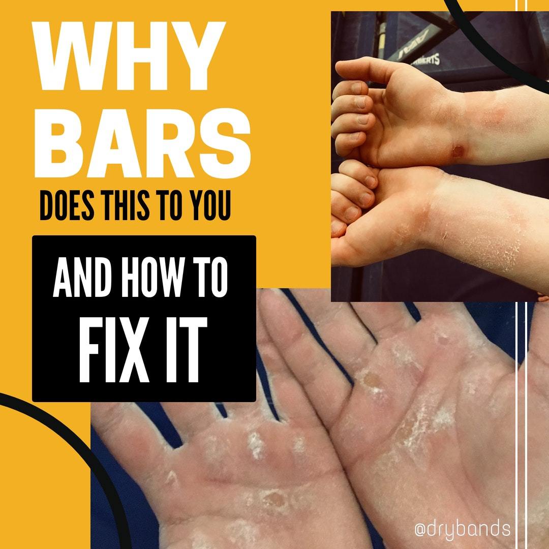 Hand Rip Bad Why do BARS cause RIPS? And how to FIX it! – DRYbands